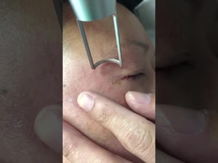 450psピコ秒 レーザー機械1064nm 532nm QはNd Yagを転換した