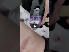 50W 断片 RF マイクロニードルマシン 100V から 240V