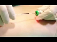 レーザー脂分解機