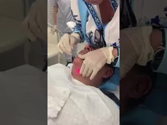 腹部治療エリア レーザー 脂質分解 1470nm ダイオードファイバーレーザーマシン